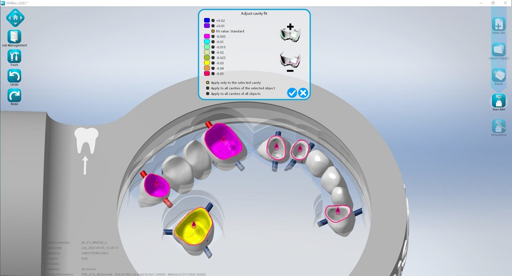 Dental manufacturing is experiencing great revolution in the develpment of new machines, tools and materials for the full digitalization of the dental manufactuing worflow. How do you choose the best CAM software to face the digital revolution in your dental laboratory or milling center? Here are 5 easy tips to get you started. Read the article.