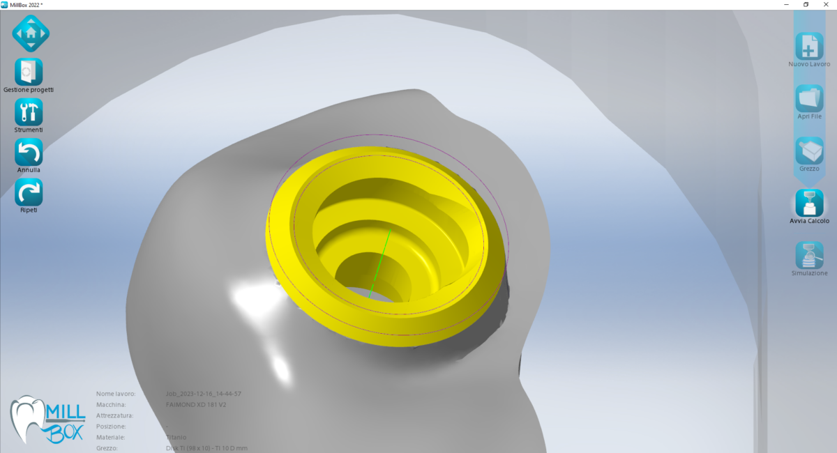 Scientific research has enabled major advances in implantology, such as the OT Bridge protocol, made from a series of innovative elements that can stabilize the prosthesis more while reducing the number of implanted screws. Read more